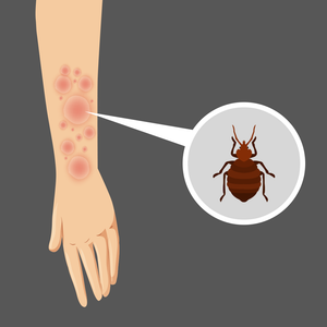 Is It Possible to Experience an Allergic Reaction From a Bed Bug Bite?