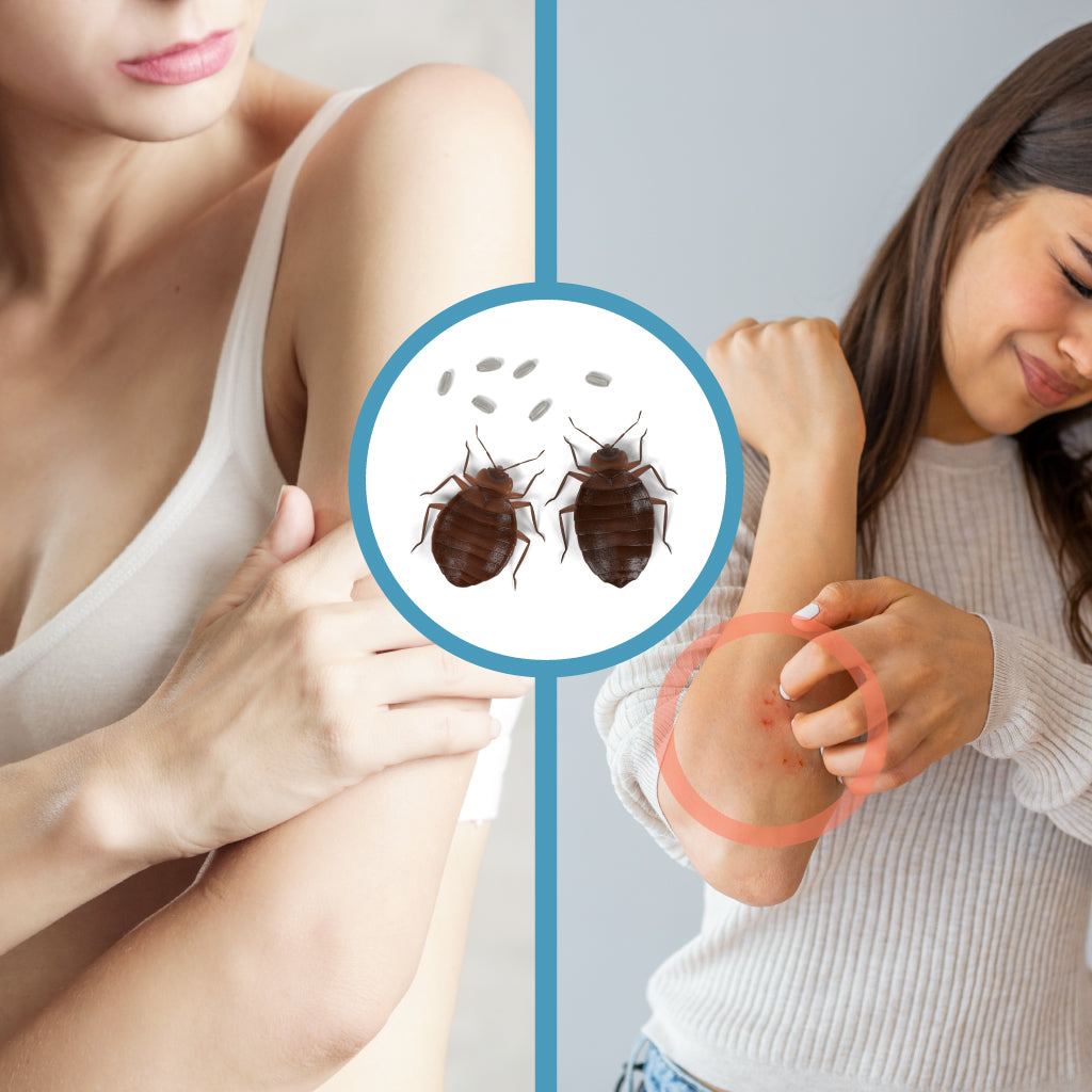 Why Do Bed Bugs Bite Some People and Not Others Bed Bug SOS